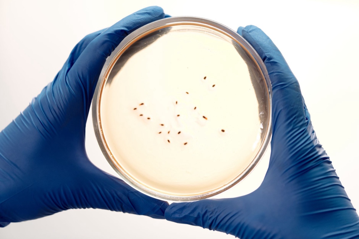 Microbe in culture dish