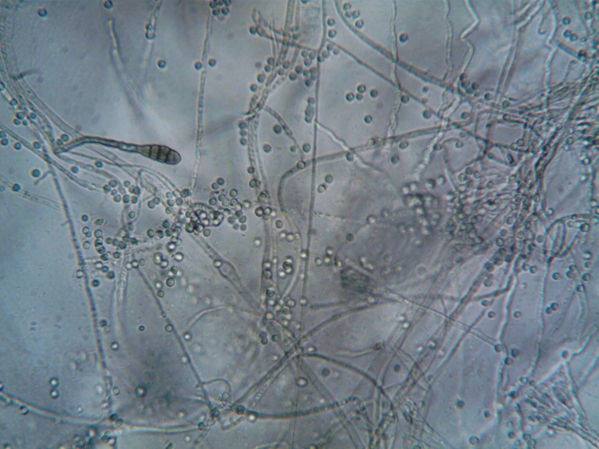 Bacterium in culture dish