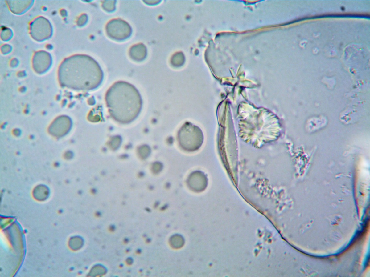 lâmina de microscópio com bactérias