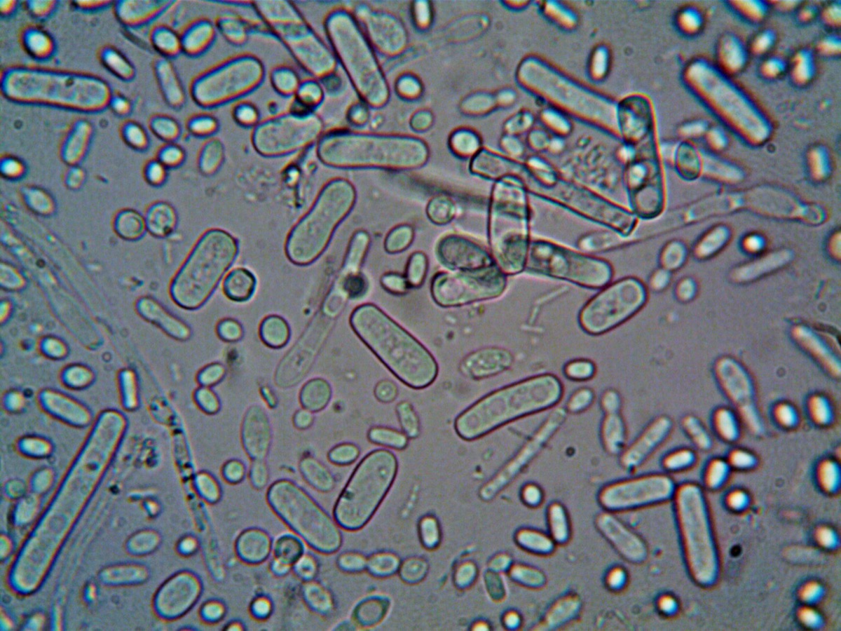 顕微鏡で見た抗生物質耐性菌