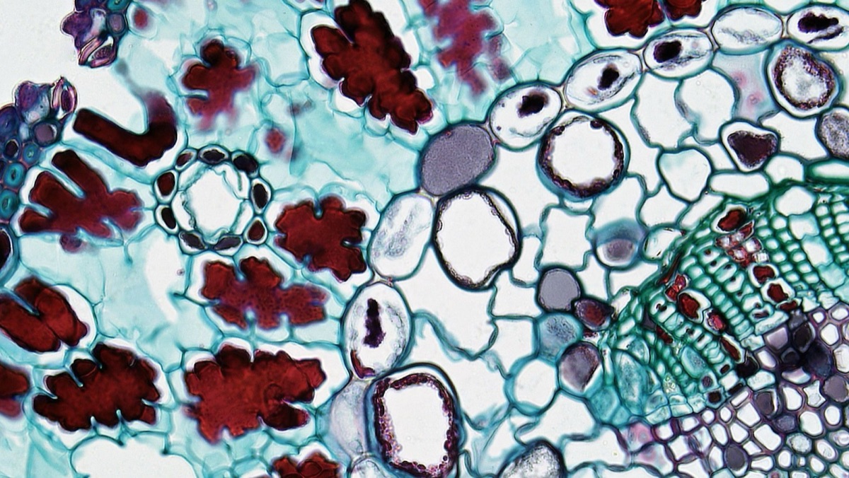Abstract microscopic view representing cellular inflammation reduction
