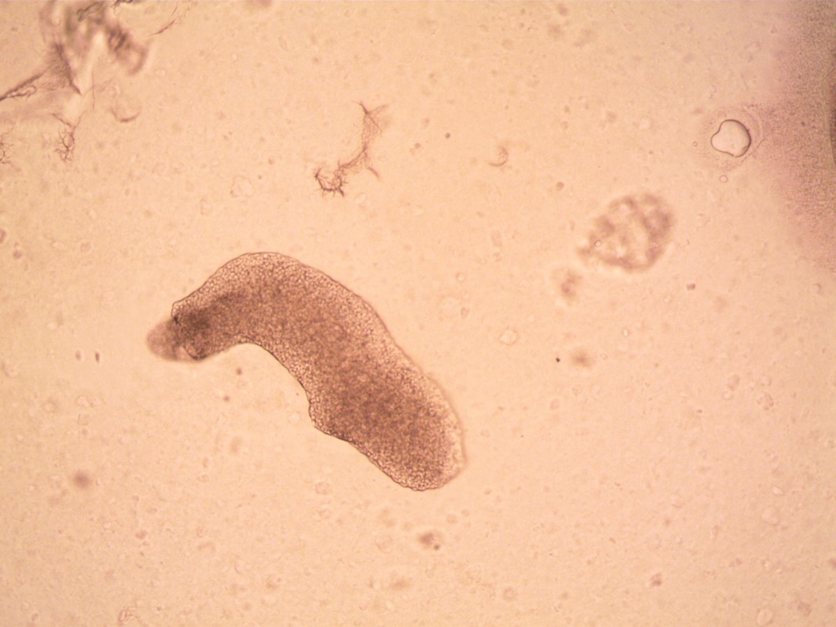 Celmembranen diffusie